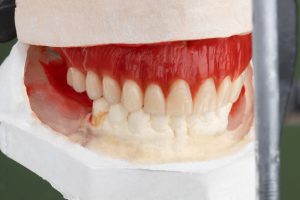 موم دندانپزشکی و دندانسازی